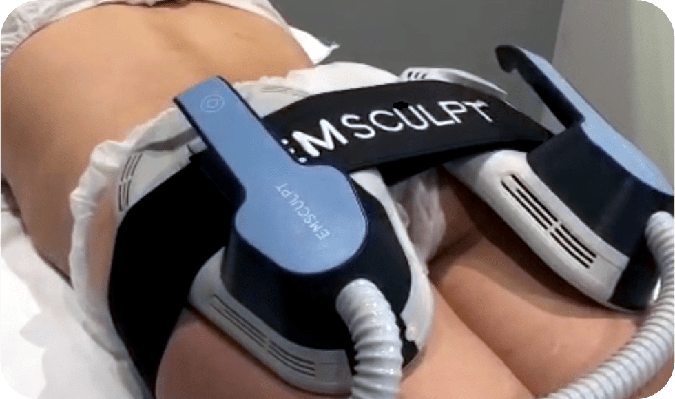 prosculpt_05__galeria_monzani
