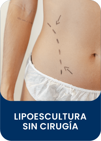servicio_lipoescultura_sin_cirugia_monzani