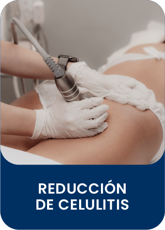 servicio_reduccion_de_celulitis_monzani